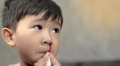澳门新京棋牌：春天天气干燥，儿童鼻炎会经常流鼻血怎么办？