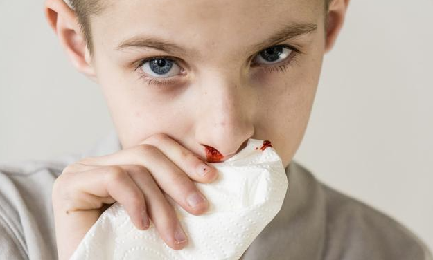 鼻出血怎样预防